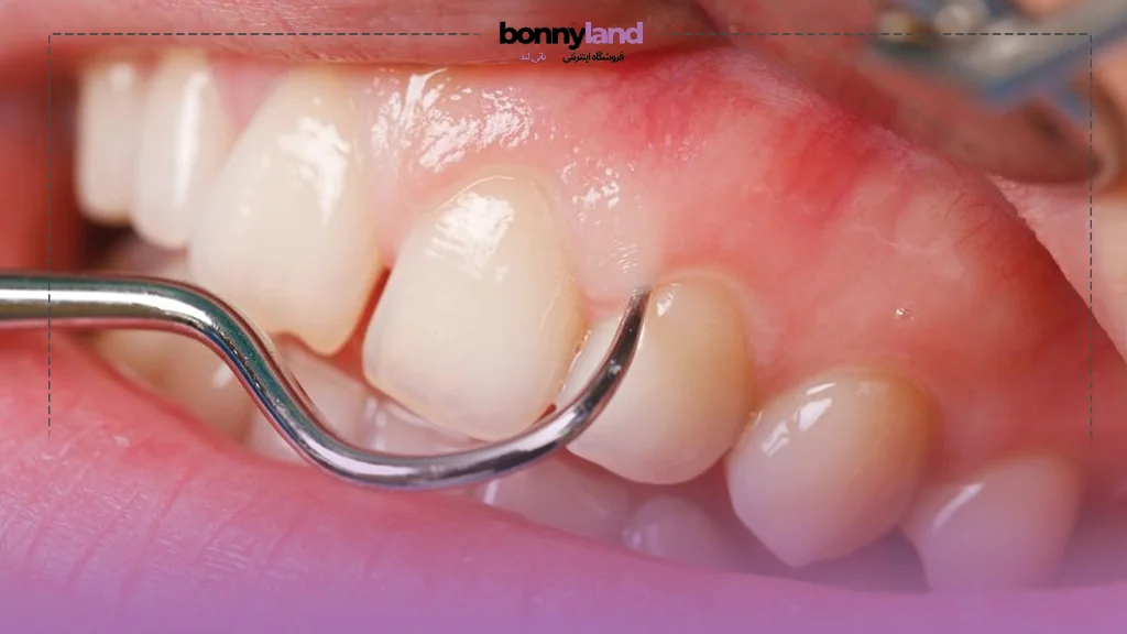 دلیل اهمیت سلامت لثه چیست؟