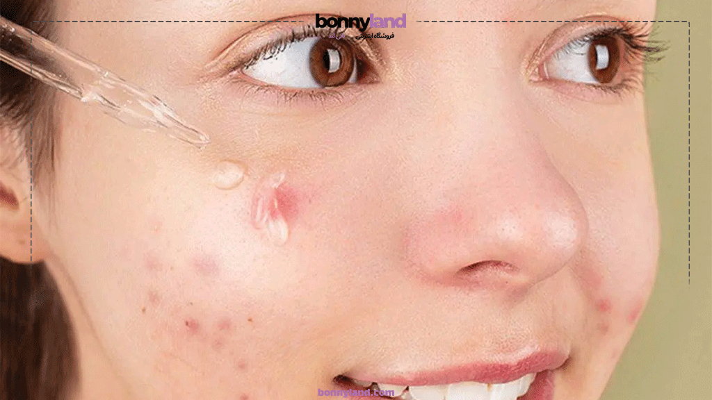 بعد از سرم ضد جوش چی بزنیم؟