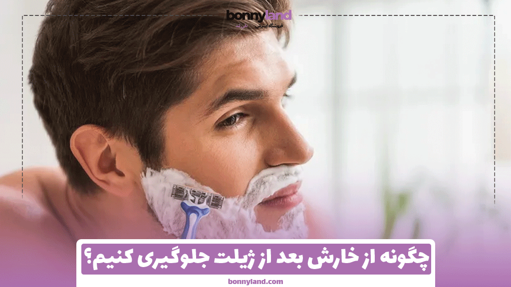 چگونه از خارش بعد از ژیلت جلوگیری کنیم؟